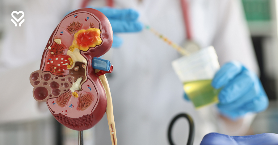 Groźne powikłanie urologiczne. Co warto wiedzieć o zakrzepie pęcherza?